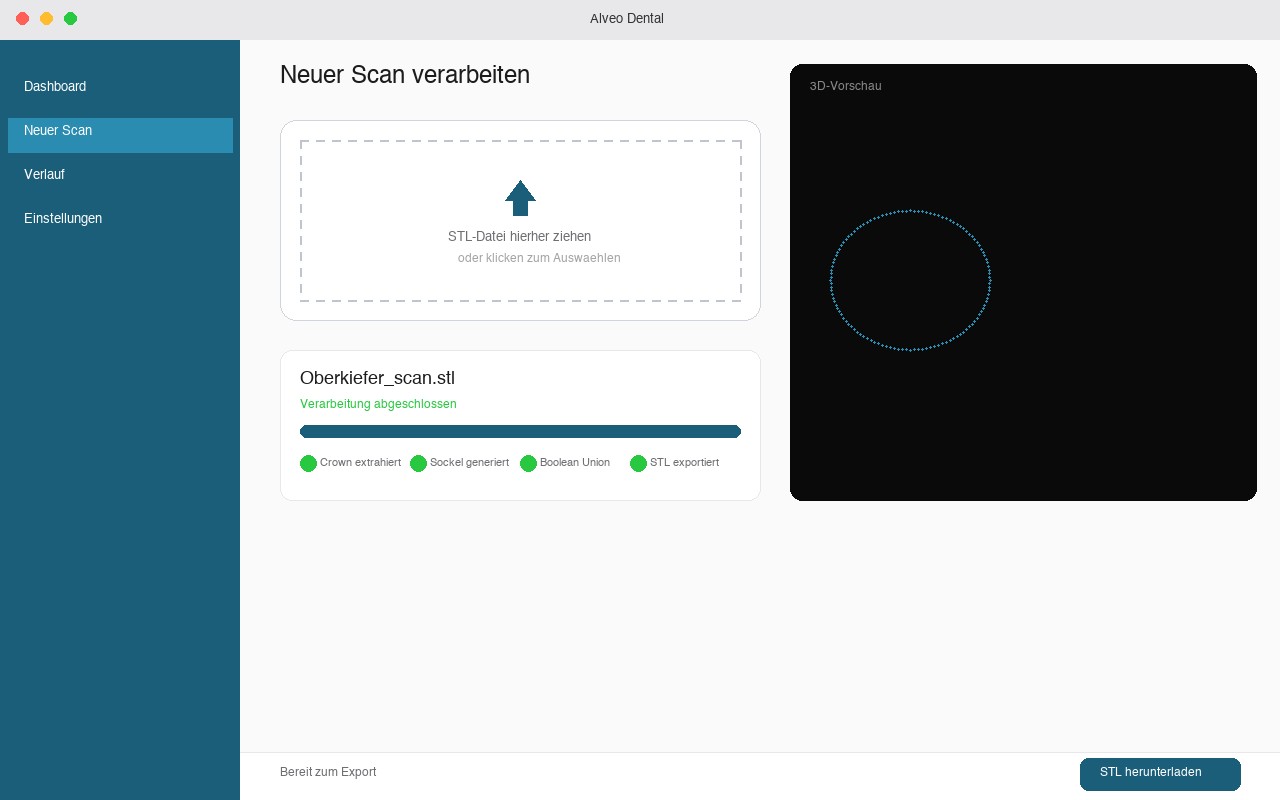 Alveo Dental App — Scan verarbeiten